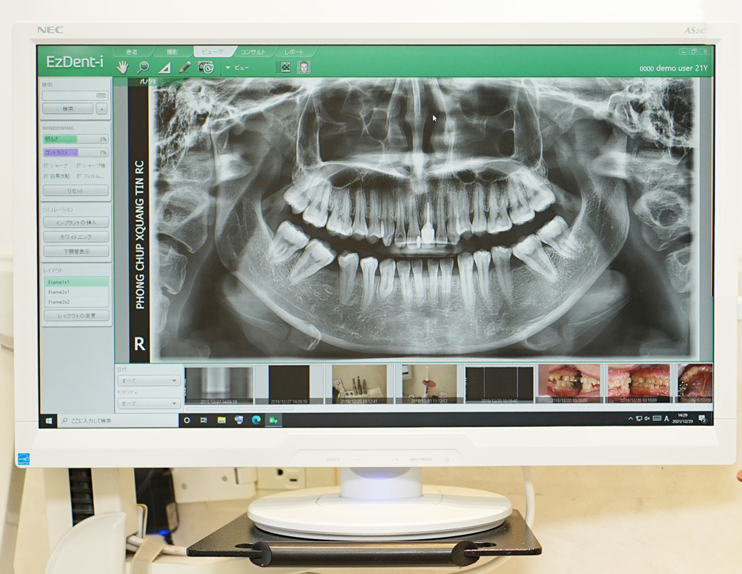 みどり歯科医院　モニター画面　CT画像