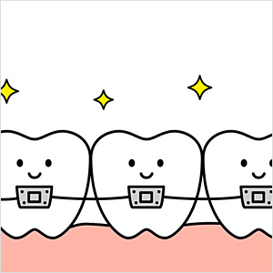 歯列矯正